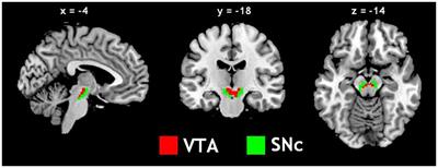 The Effects of Age, from Young to Middle Adulthood, and Gender on Resting State Functional Connectivity of the Dopaminergic Midbrain